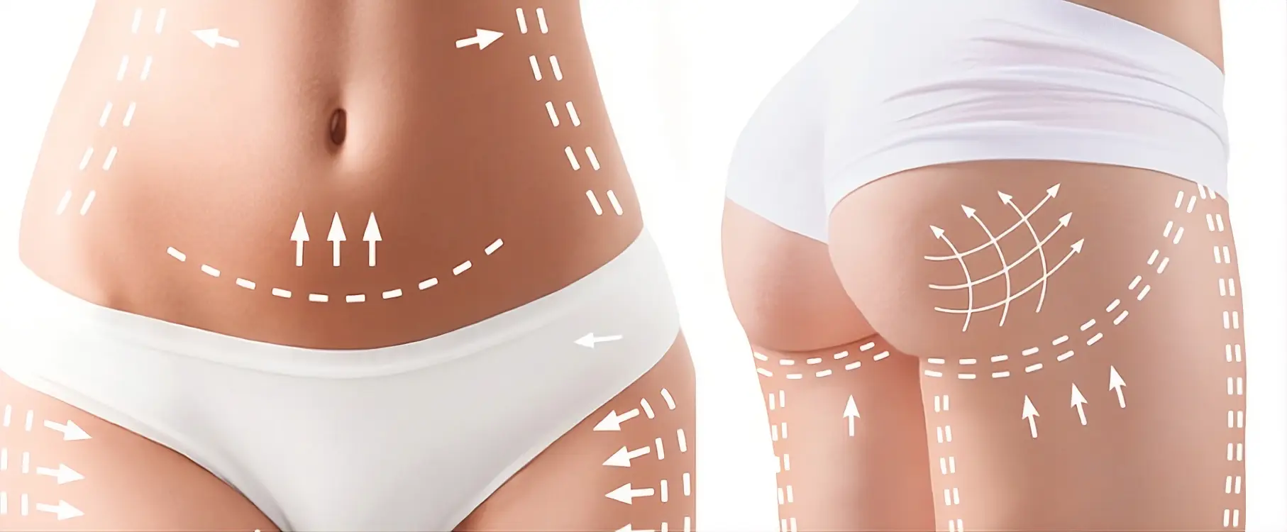 V-Shape Dorian Gray Vip